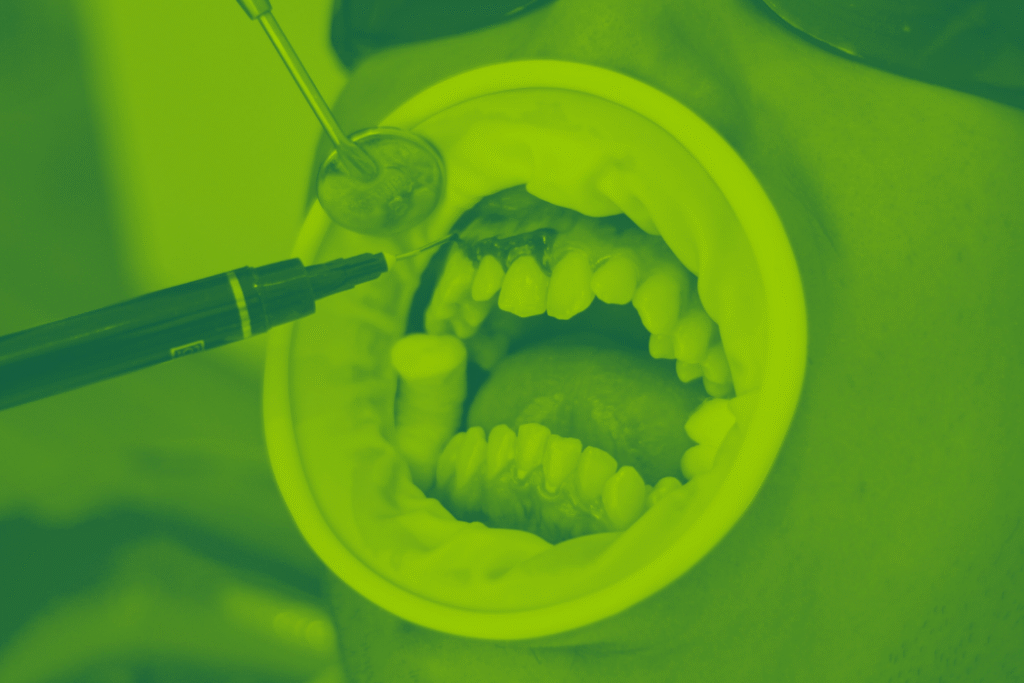 dental spa dokter gigi malang