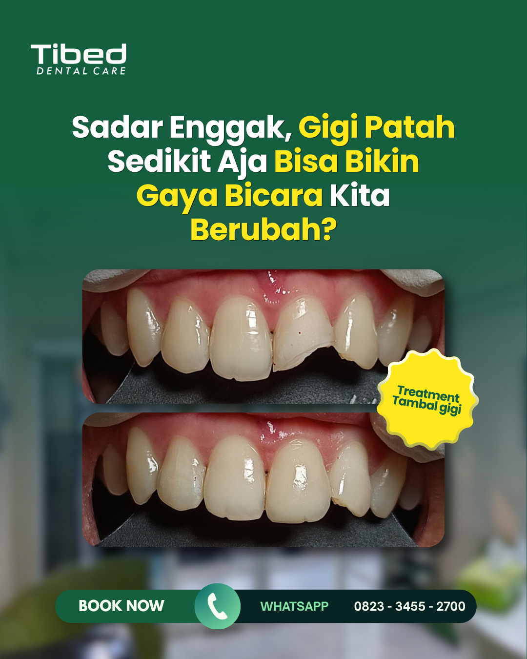 tambal gigi depan di malang dokter gigi malang terdekat tambal estetik